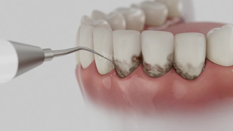 Reliable Dental Implants contractor in Thatcher, AZ by Smile Center Dentistry